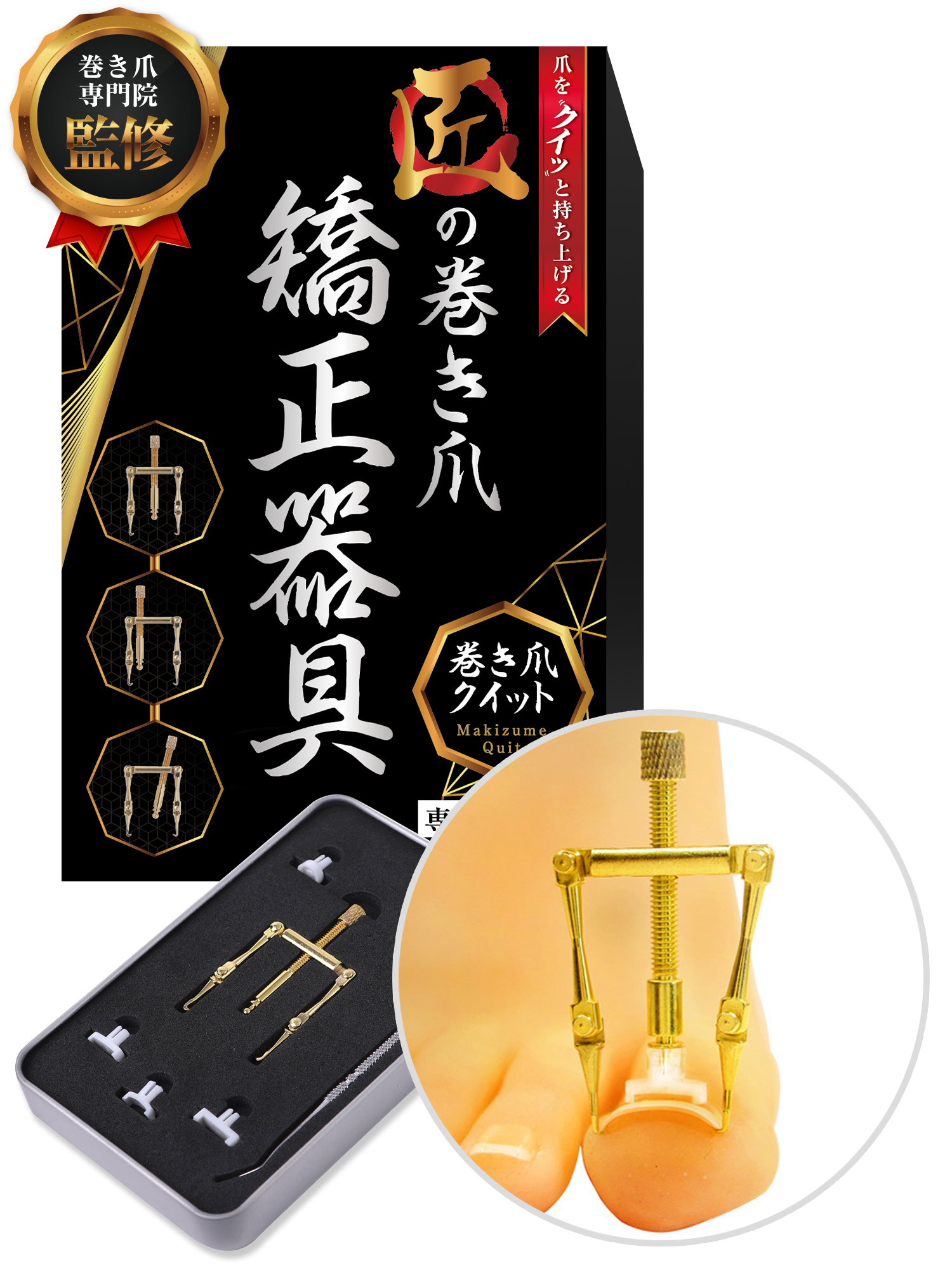 匠の巻き爪矯正器具 巻き爪クイット