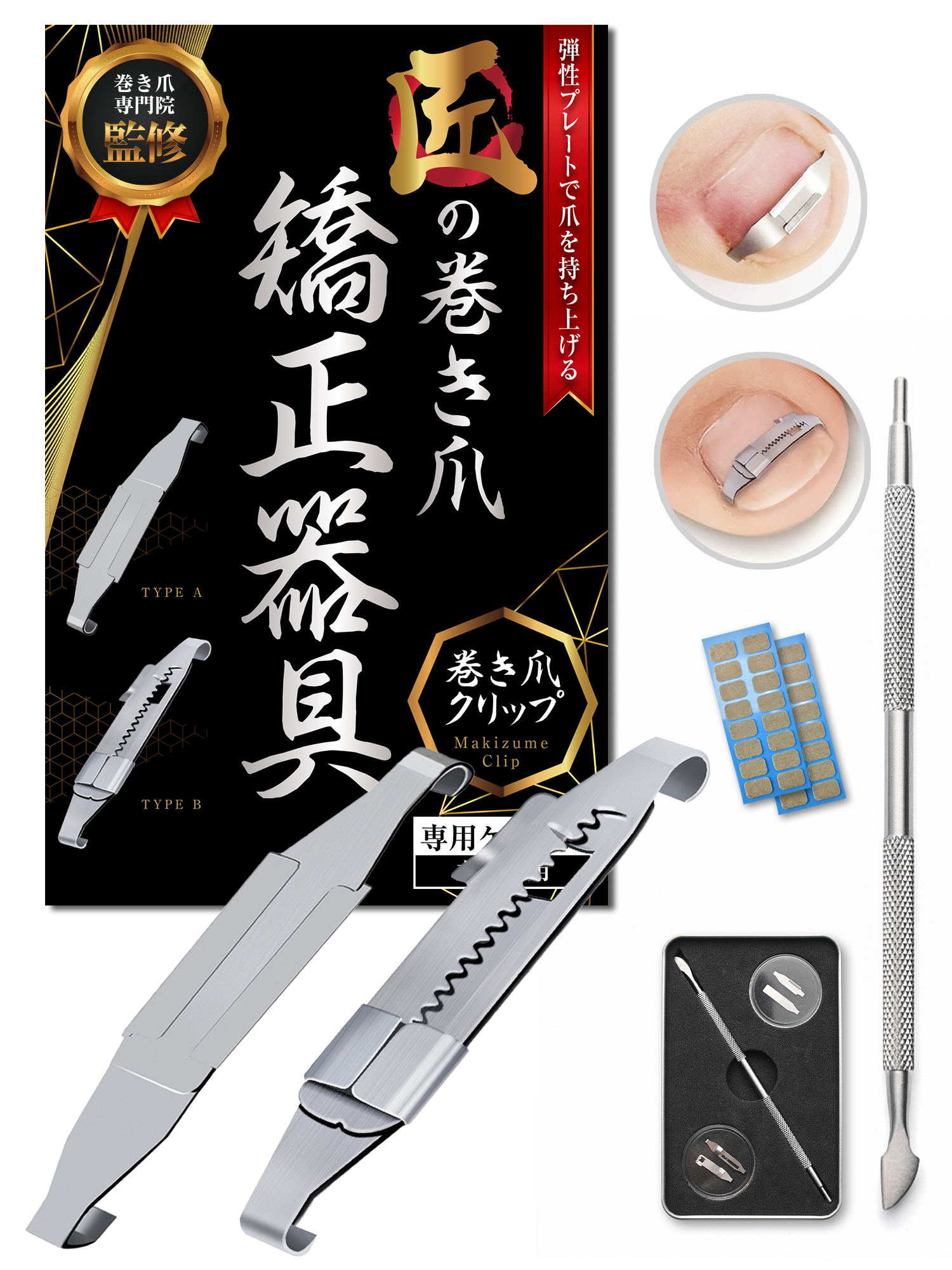 匠の巻き爪矯正器具 巻き爪クリップ